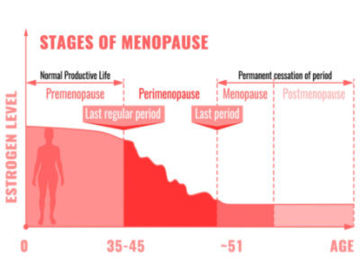 menopause